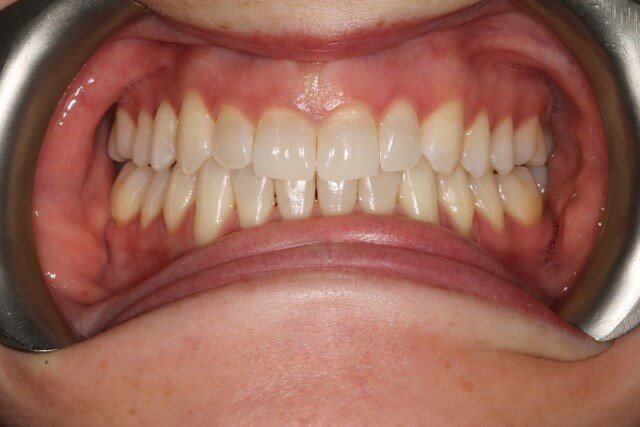 3 After Gentle Dental Care