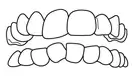 Same day teeth
