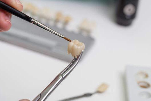 Dental Crown Dental Crown