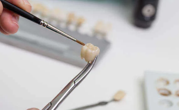Dental Crown