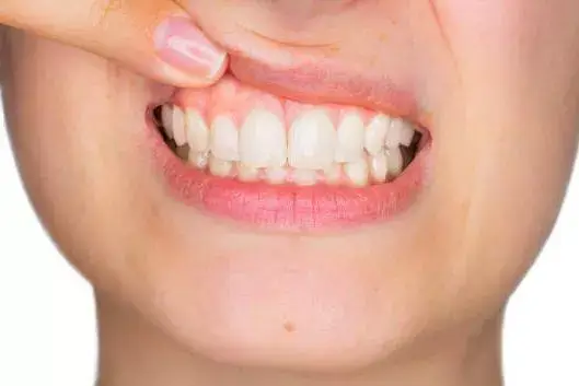 Gum Specialist Gum Specialist