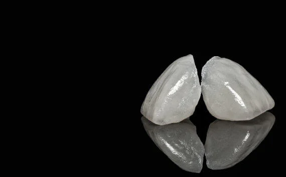 What material is used for dental crowns