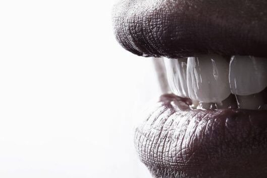Dental Implants Dental Implants