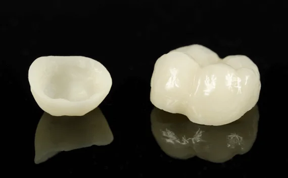 crowns