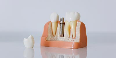 Gentle Dental Care