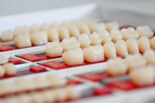 dental-implants dental-implants