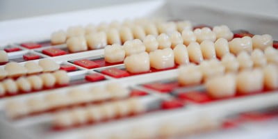 dental-implants