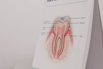 tooth-diagram350 tooth-diagram350