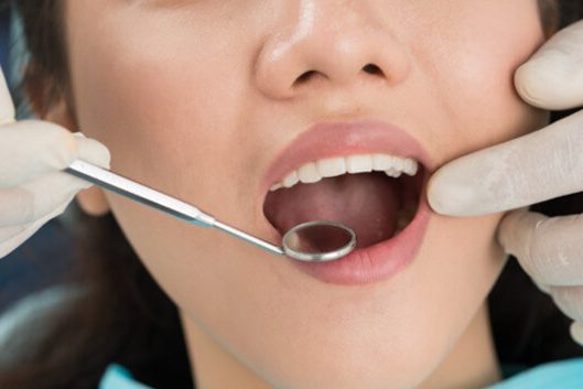 dangers-of-having-dental-work-abroad-featured-img dangers-of-having-dental-work-abroad-featured-img