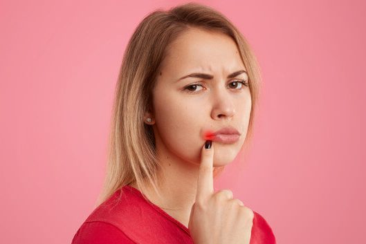 mouth-ulcers-featured mouth-ulcers