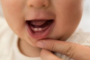 what-age-do-children-lose-teeth