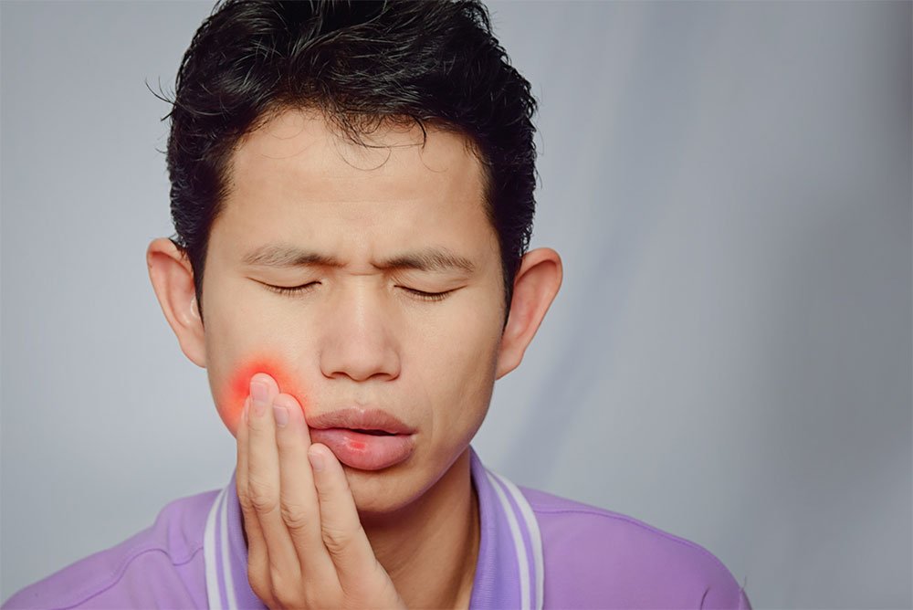 What causes mouth ulcers? Dentist in Croydon