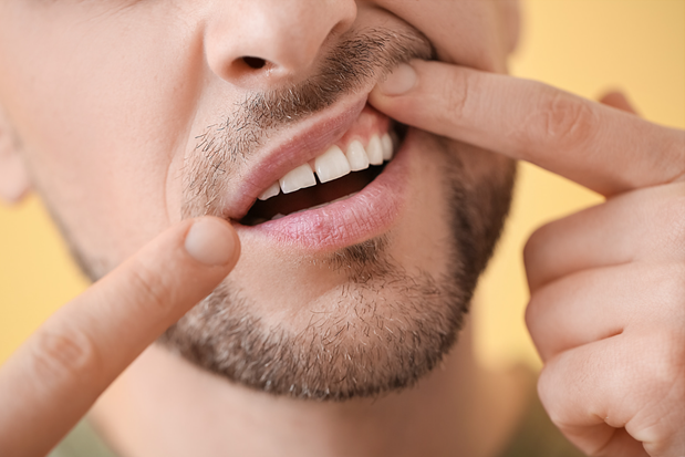 man-teeth man-teeth