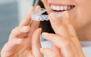 Invisalign braces