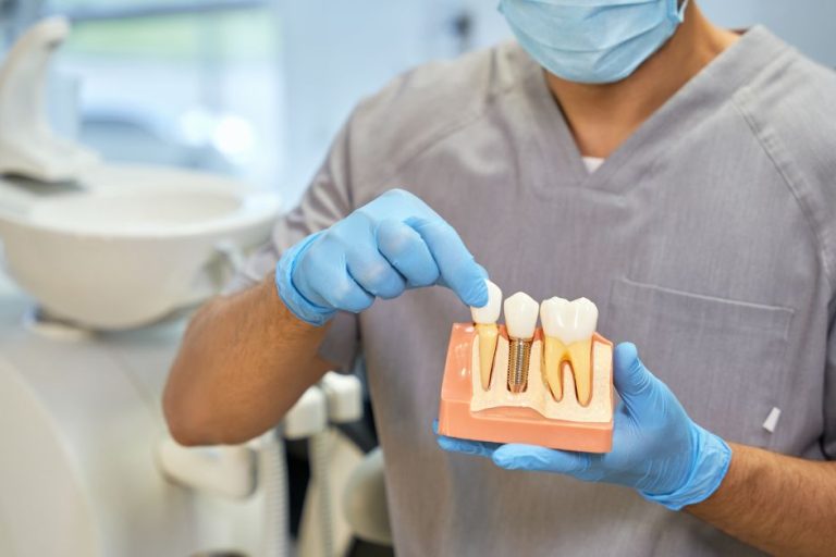 Skillful dental technician showing anatomy of dental implant Skillful dental technician showing anatomy of dental implant